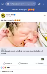 Torna la bufala del bimbo nato con la spirale in mano